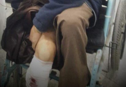 یک سارق مسلح زخمی در هرات دستگیر شد