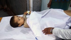 دو کودک در فراه طعمه مواد انفجاری شدند