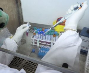 در 24 ساعت اخیر 10 تن قربانی کرونا شدند
